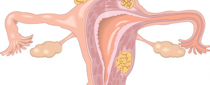Σαλπιγγογραφία στο Κέντρο Γονιμότητας Κρήτης